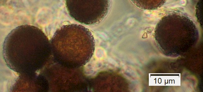 Sporen von Elaphomyces muricatus